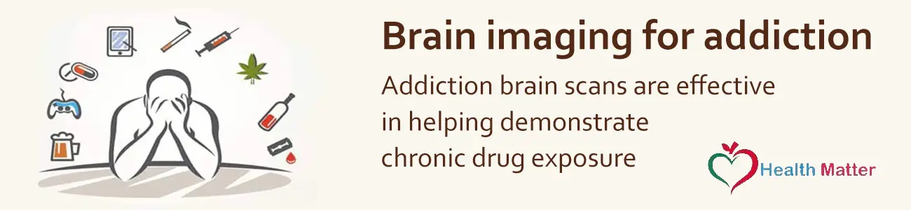 Brain Scans Of Drug Addicts- How Are They Effective?