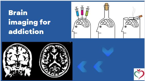 Brain Imaging for Addiction